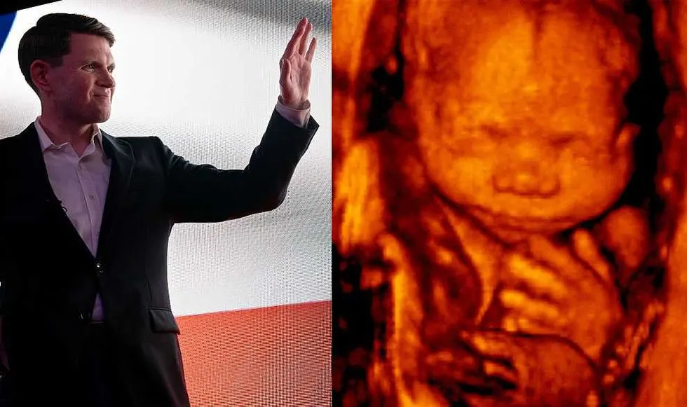 Split image: man in dark suit gesturing beside a 3D ultrasound of a fetus.
